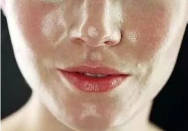 不同膚質應該如何正確護膚？