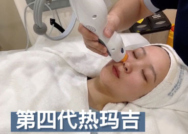 熱瑪吉的效果可以維持多久？熱瑪吉的效果可以保持一年嗎？