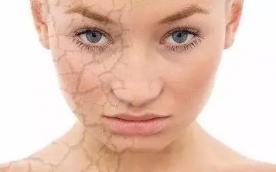 肌膚刺癢是什么原因？是哪些因素造成肌膚刺癢的現(xiàn)象？