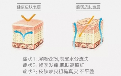 敏感肌與過(guò)敏肌的區(qū)別是什么？