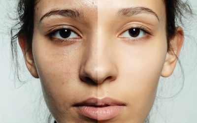 皮膚暗沉的原因有哪些？