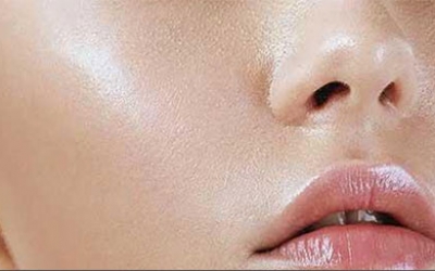 臉上光出油是什么原因？