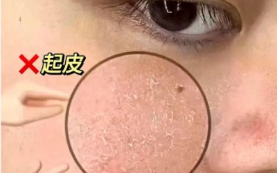 化完妝后臉上起皮怎么補(bǔ)救？